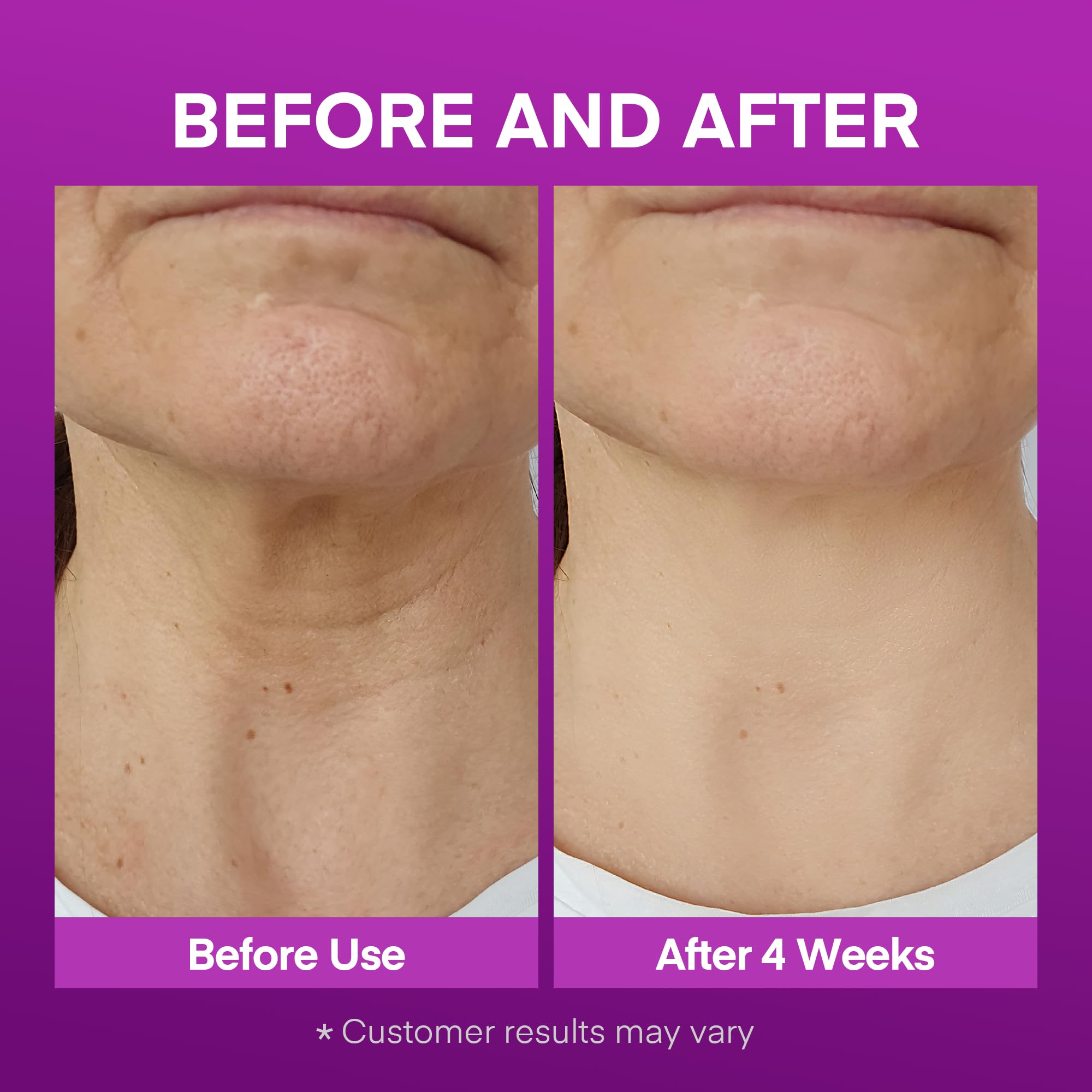 Vigority Korean Neck Firming Cream with Centella Asiatica - Vigority Official Imagery - 3