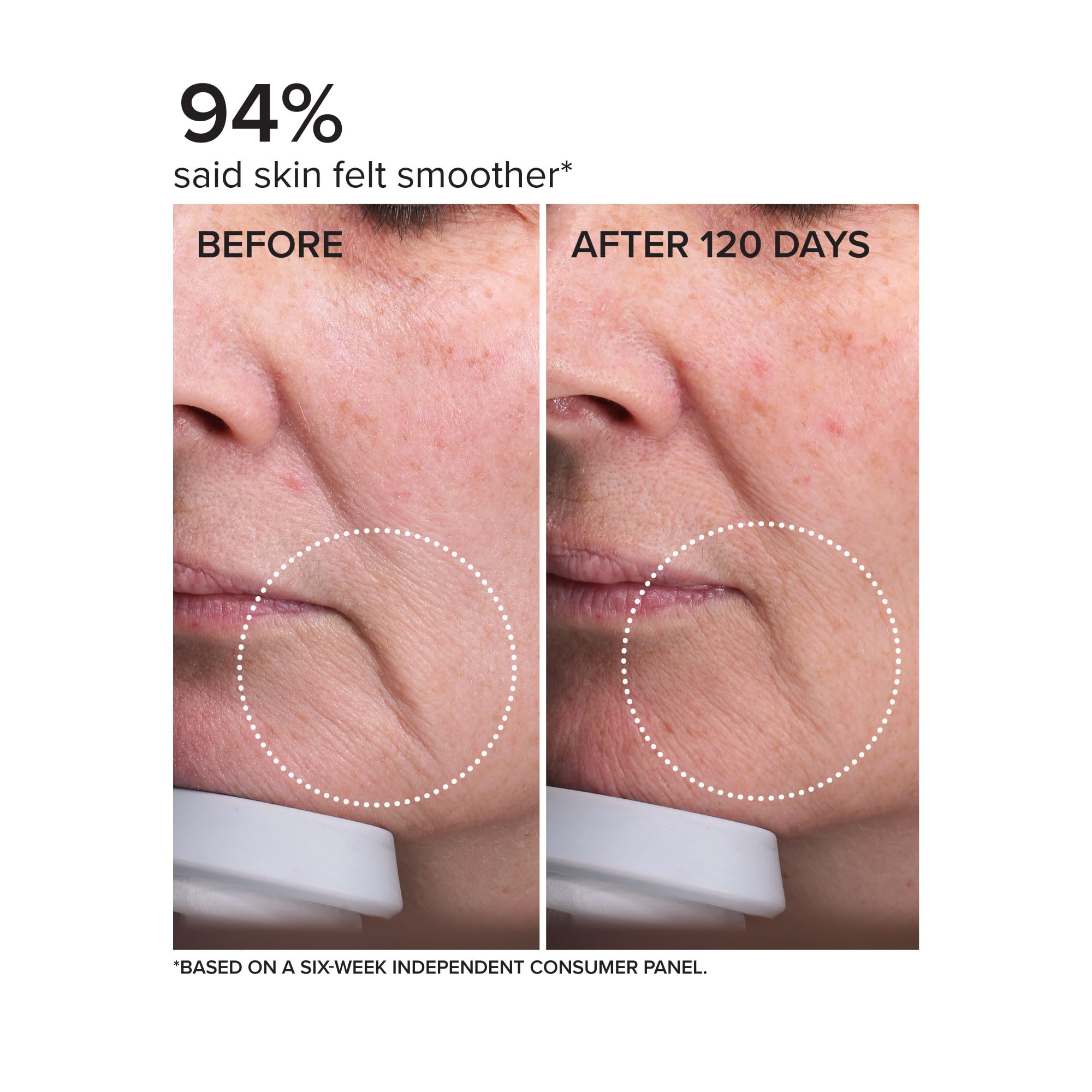 DRMTLGY Needle less Serum - DRMTLGY Official Imagery - 6