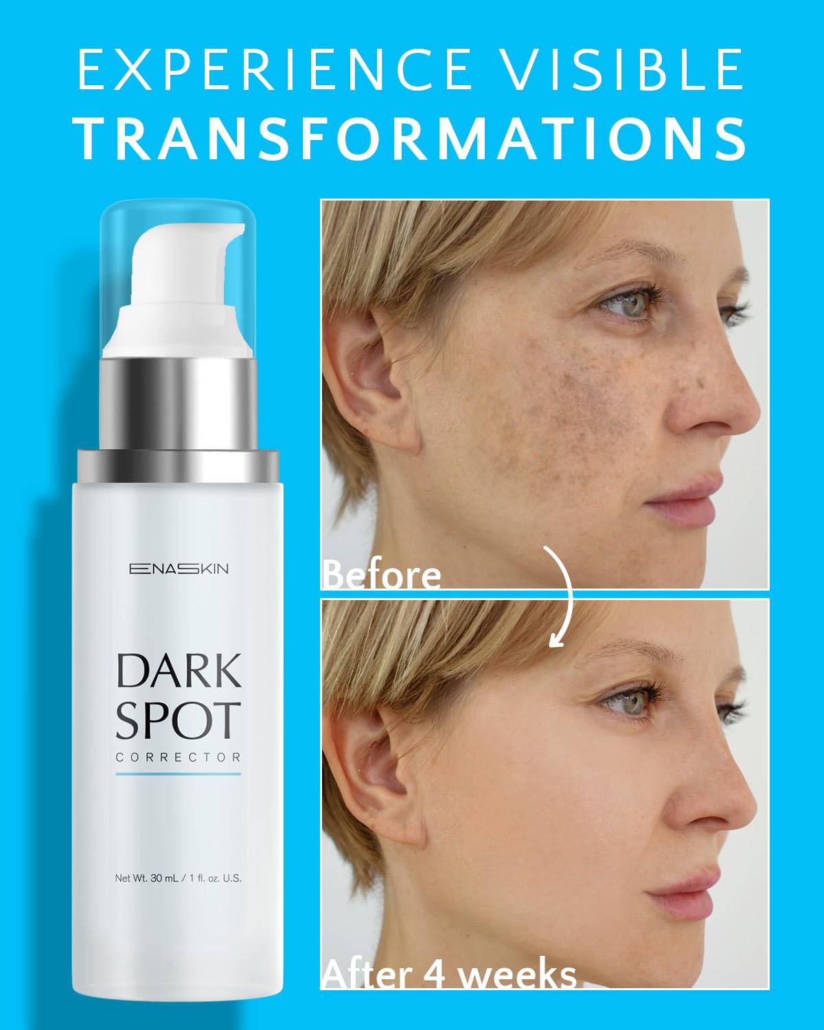 EnaSkin Dark Spot Corrector Serum 5% Tranexamic Acid