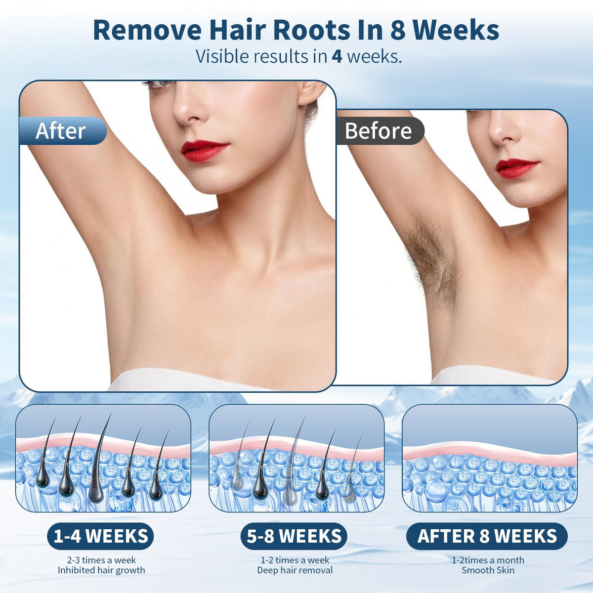Laser Hair Removal for Women At home 5 Ice Cooling IPL Hair - BLHVSINO1 Official Imagery - 8