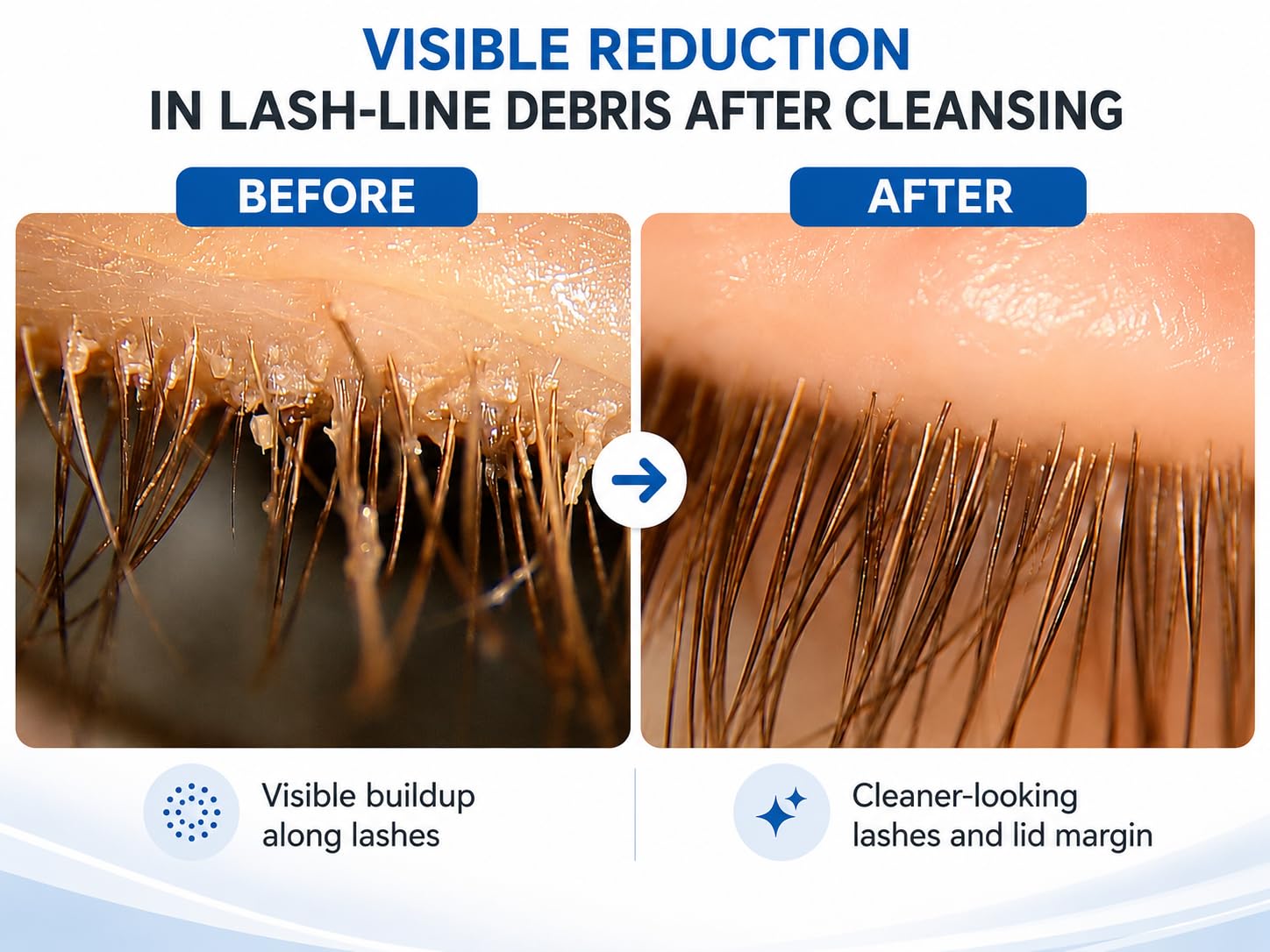 Mybo Clean Eyelid Cleansing Brush for Sensitive Skin - Myboclean Official Imagery - 3