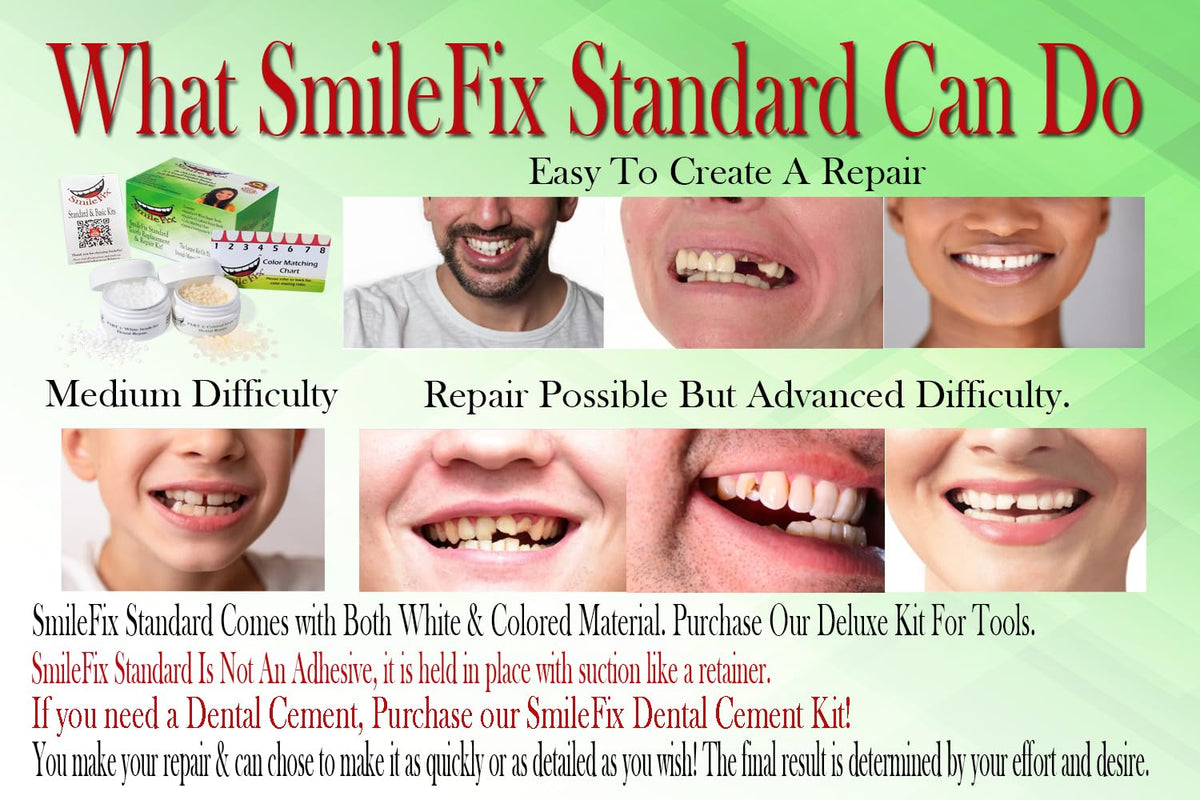 SmileFix Standard Dental Repair Kit - Smile Fix Official Imagery - 3