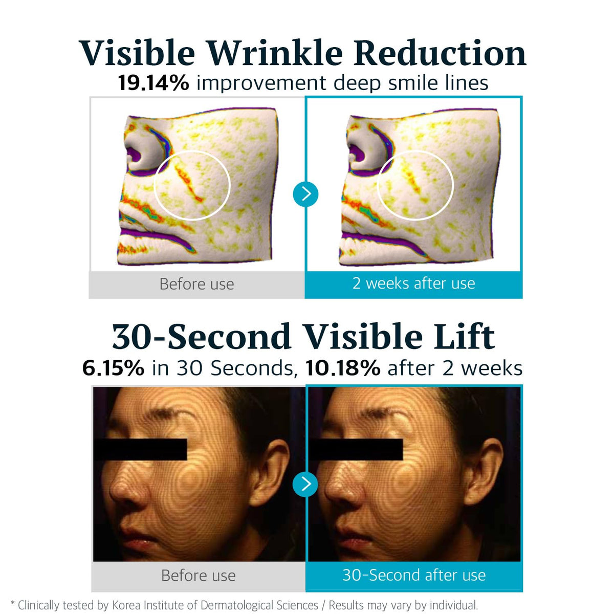 Re SPN Under Eye Patches Peptide Lifting Serum - AlwayNu Re.SPN Official Imagery - 5