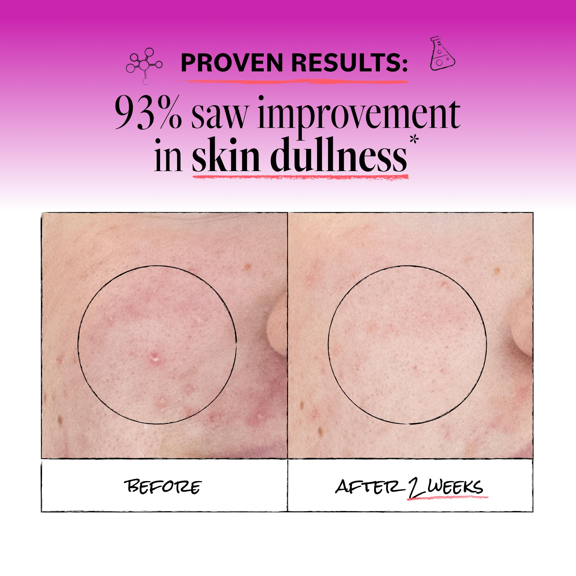 DERMA E Microdermabrasion Exfoliating Face Scrub, Revitalizes & Renews - Derma E Official Product View 4