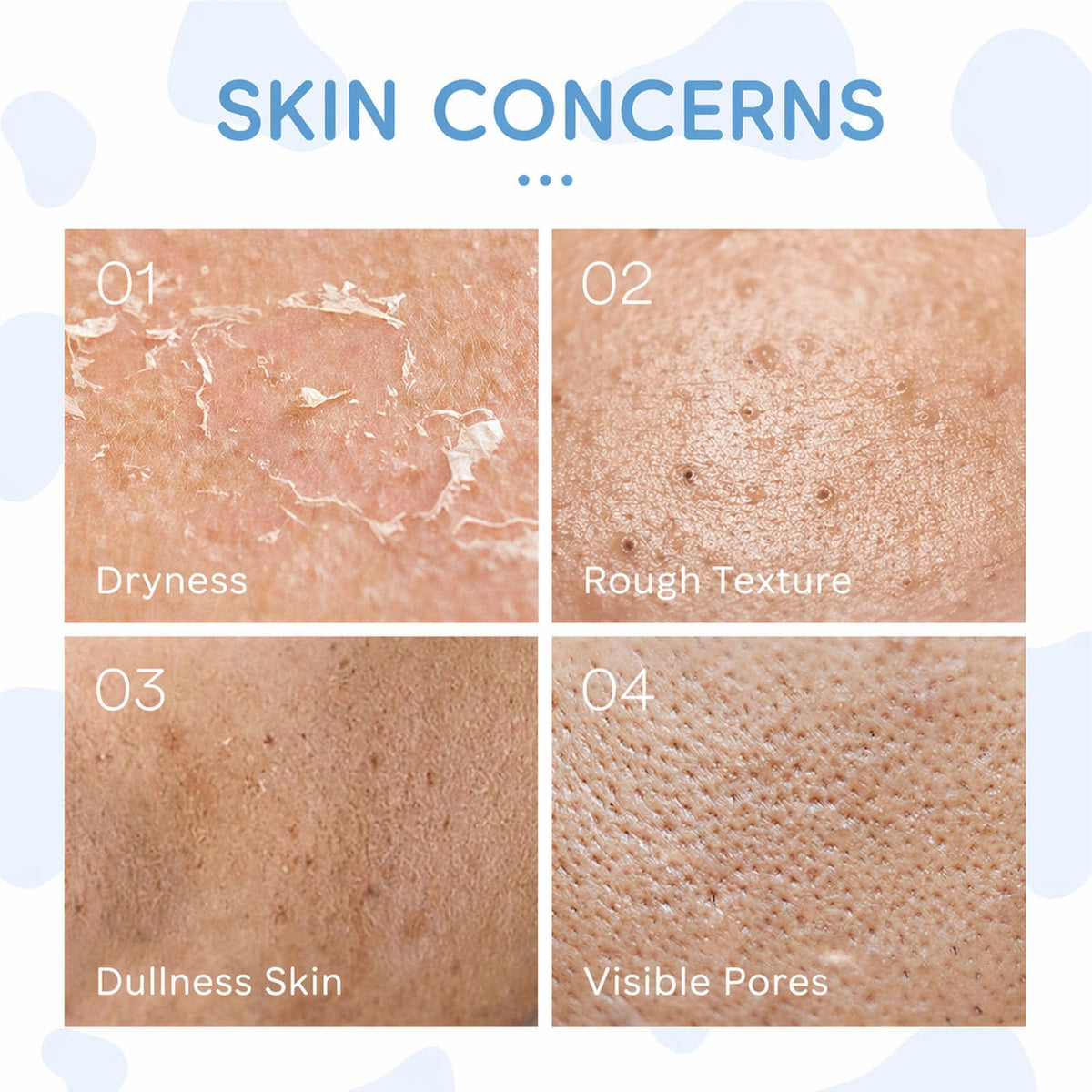INSEEK Milk Skincare Set for Women and Teens Deep - INSEEK Official Imagery - 3