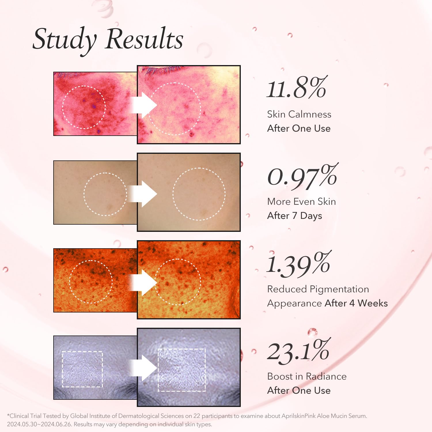 APRILSKIN Pink Aloe Mucin Serum - APRILSKIN Official Product View 5