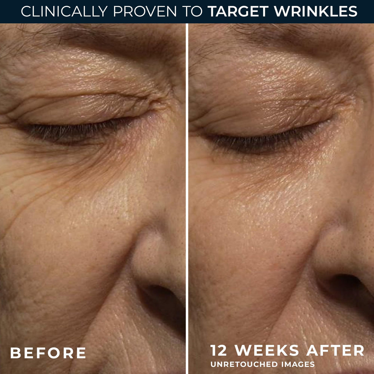 RoC Retinol Correxion Deep Wrinkle Anti Aging Night Cream - RoC Official Imagery - 5