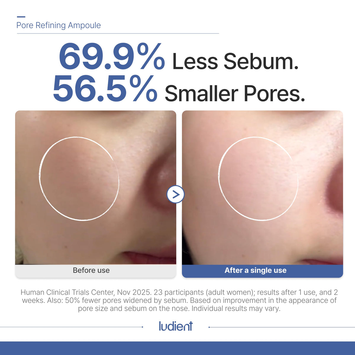 Pore Minimizer for Face Korean Retinol Serum for Face 1 01 - ludient Official Product Imagery - 5