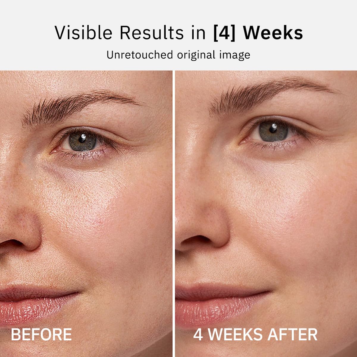 HKH Vitamin C Serum Capsules For Face 48 Caps Anti Aging - HKH Official Imagery - 7