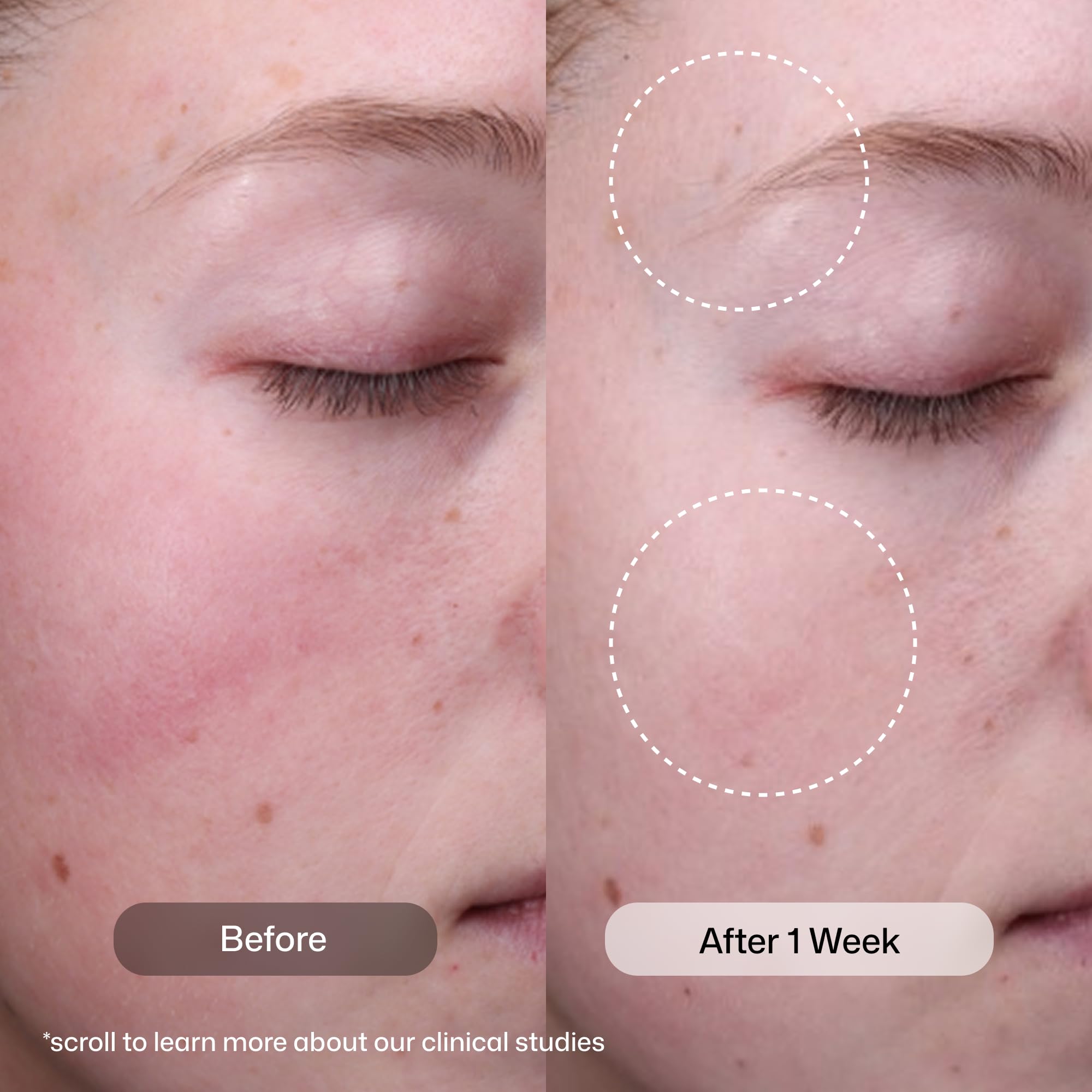 Revision Skincare Radiance Resurfacing AHA BHA Exfoliating - Revision Skincare Official Product Imagery - 4