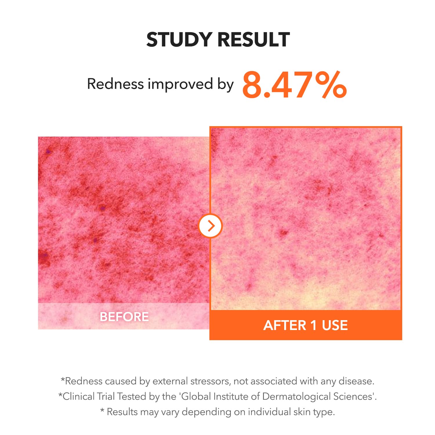 APRILSKIN Carrotene IPMP Clearing Solution - APRILSKIN
