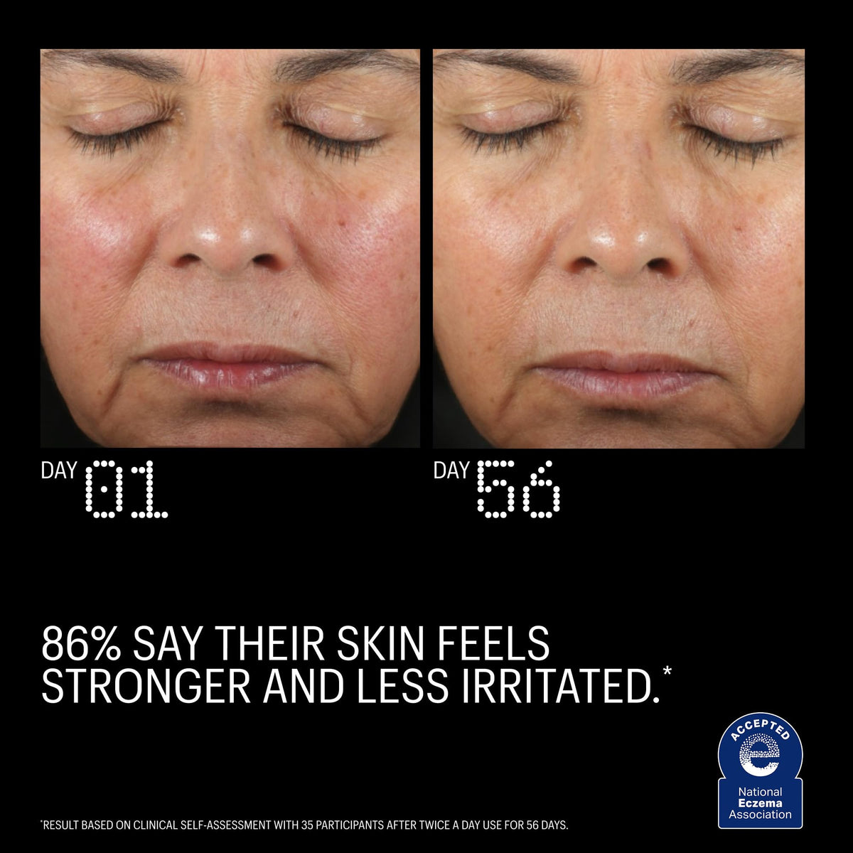 Allies of Skin Copper Tripeptide Ectoin Advanced Repair Face - Allies of Skin Official Imagery - 6