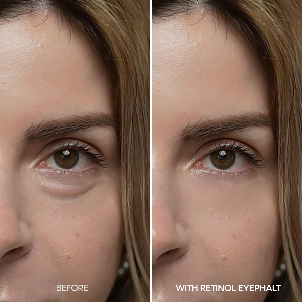 Dr Melaxin Retinol Eyebag Cream for Puffiness Dark Circles - Dr.Melaxin Official Imagery - 5