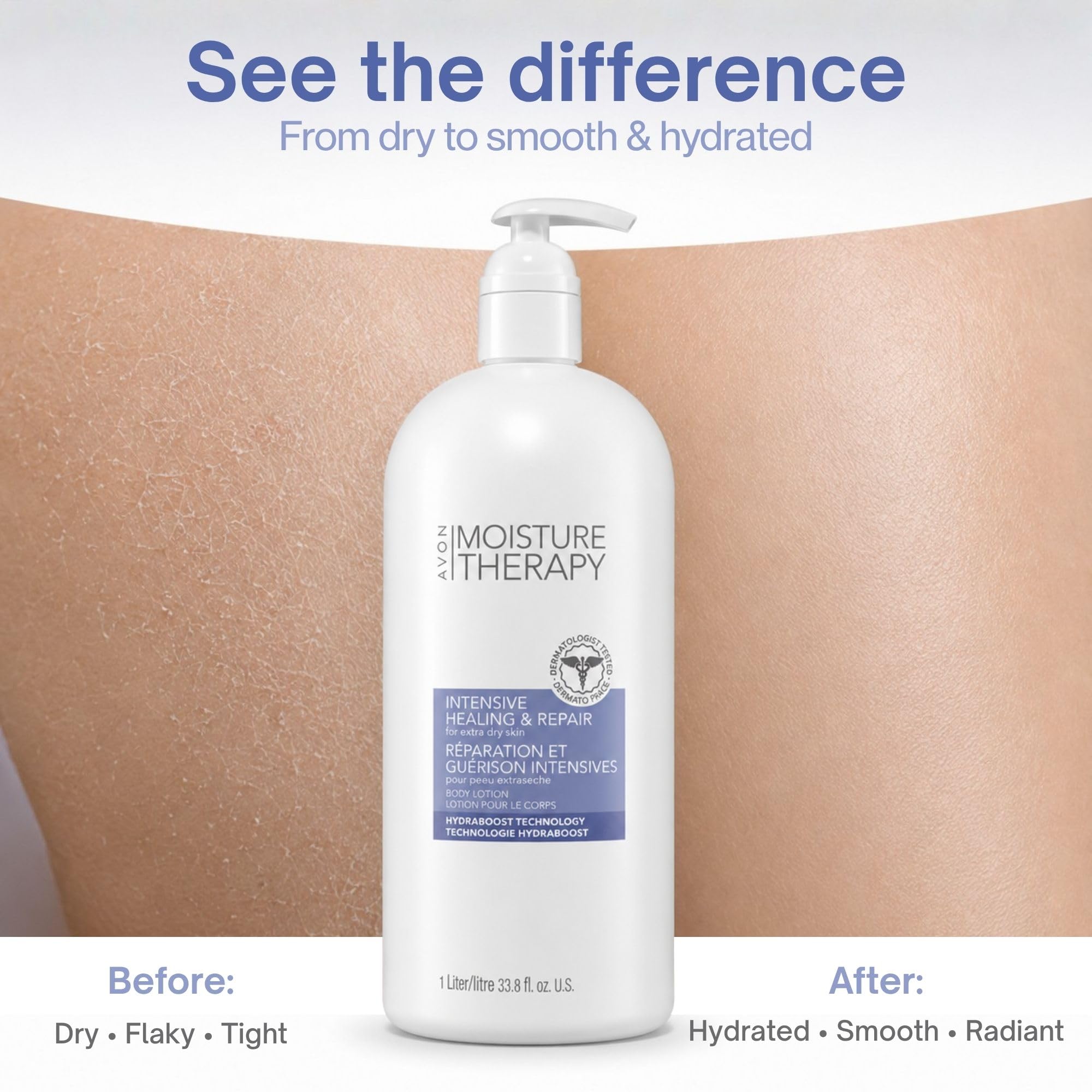 AVON Moisture Therapy Intensive Healing Repair Body Lotion - AVON Official Imagery - 4