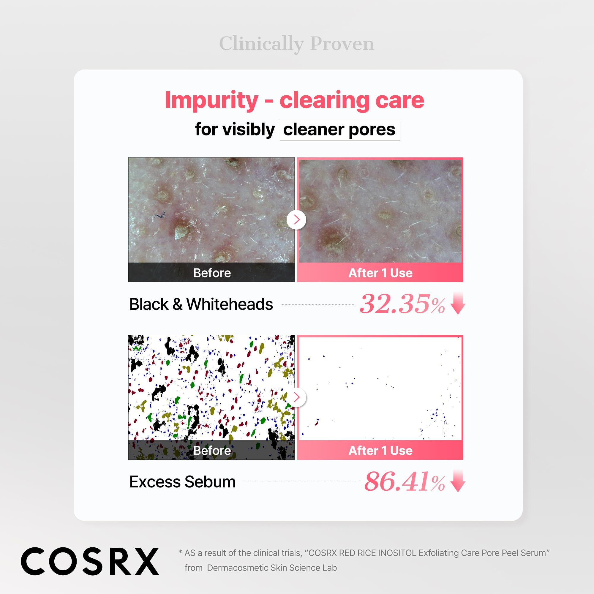 COSRX Red Rice Pore Peel Shot, Blackhead Remover AHA BHA PHA, - COSRX