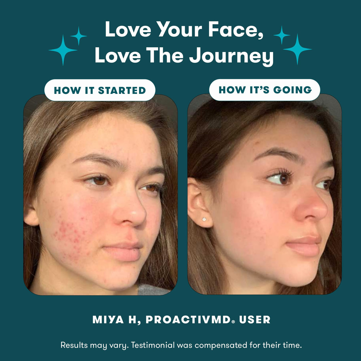 Proactiv MD 3 Step Routine Ultra Gentle Face Cleanser 0 1 - Proactiv Official Imagery - 5