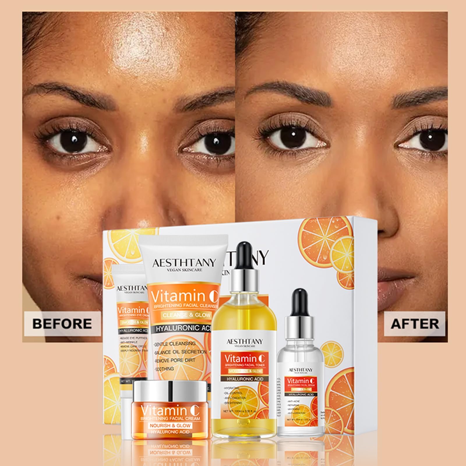 Vitamin C Skin Care Set For Women , 5-In-1 Moisturizing - R RadiantRise