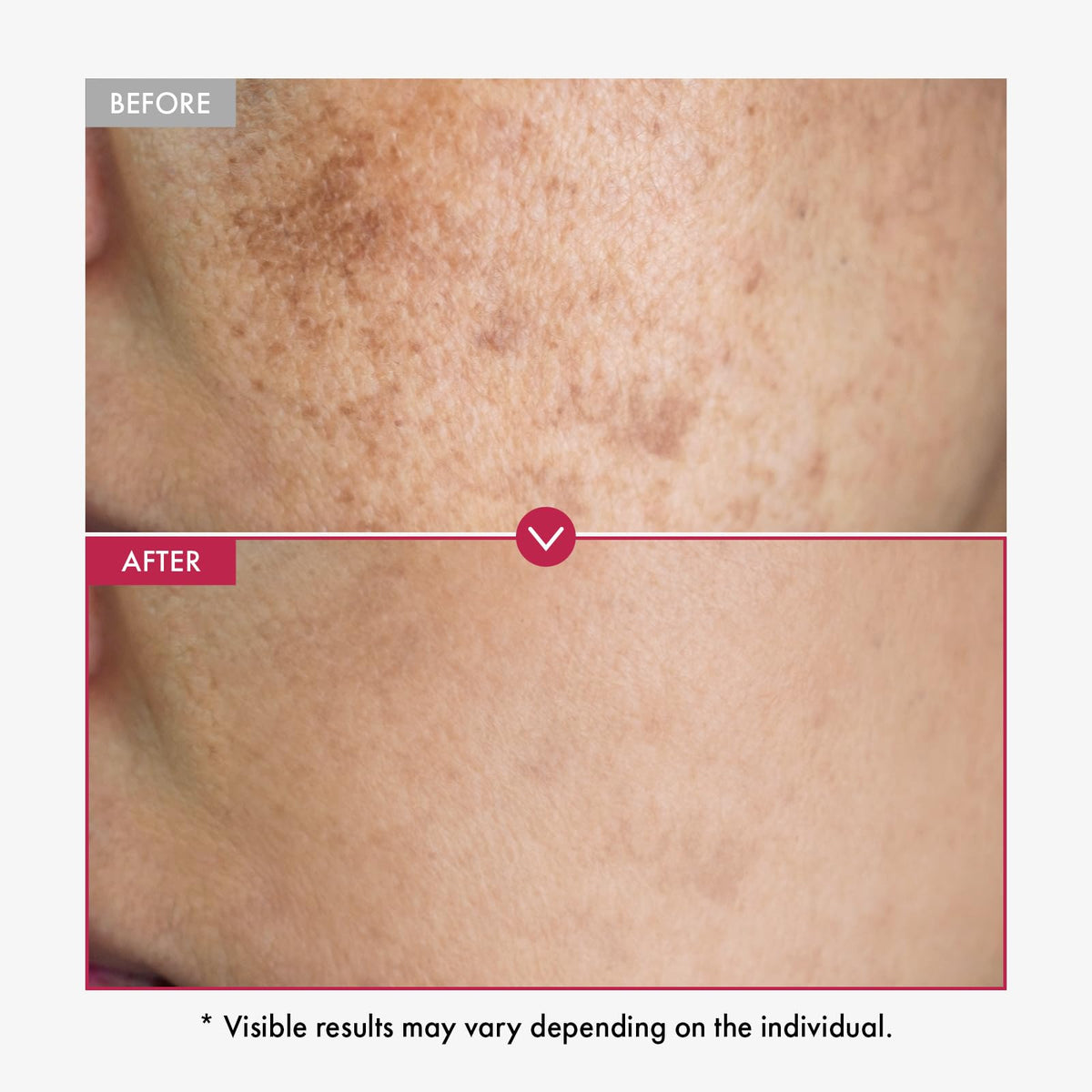 TOSOWOONG Niacinamide 10 Tranexamic Acid 4 Serum for Radiant - TOSOWOONG Official Imagery - 4