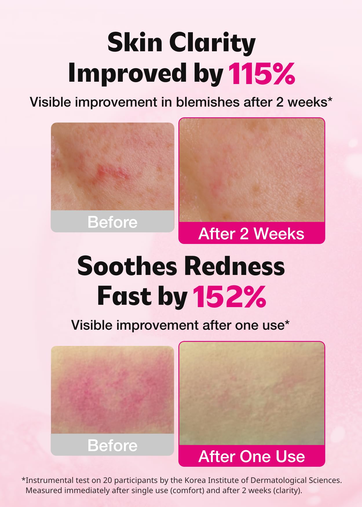 ISOI Blemish Care Up Serum with Arbutin Rose Otto Oil 1 18 - ISOI Official Product Imagery - 4