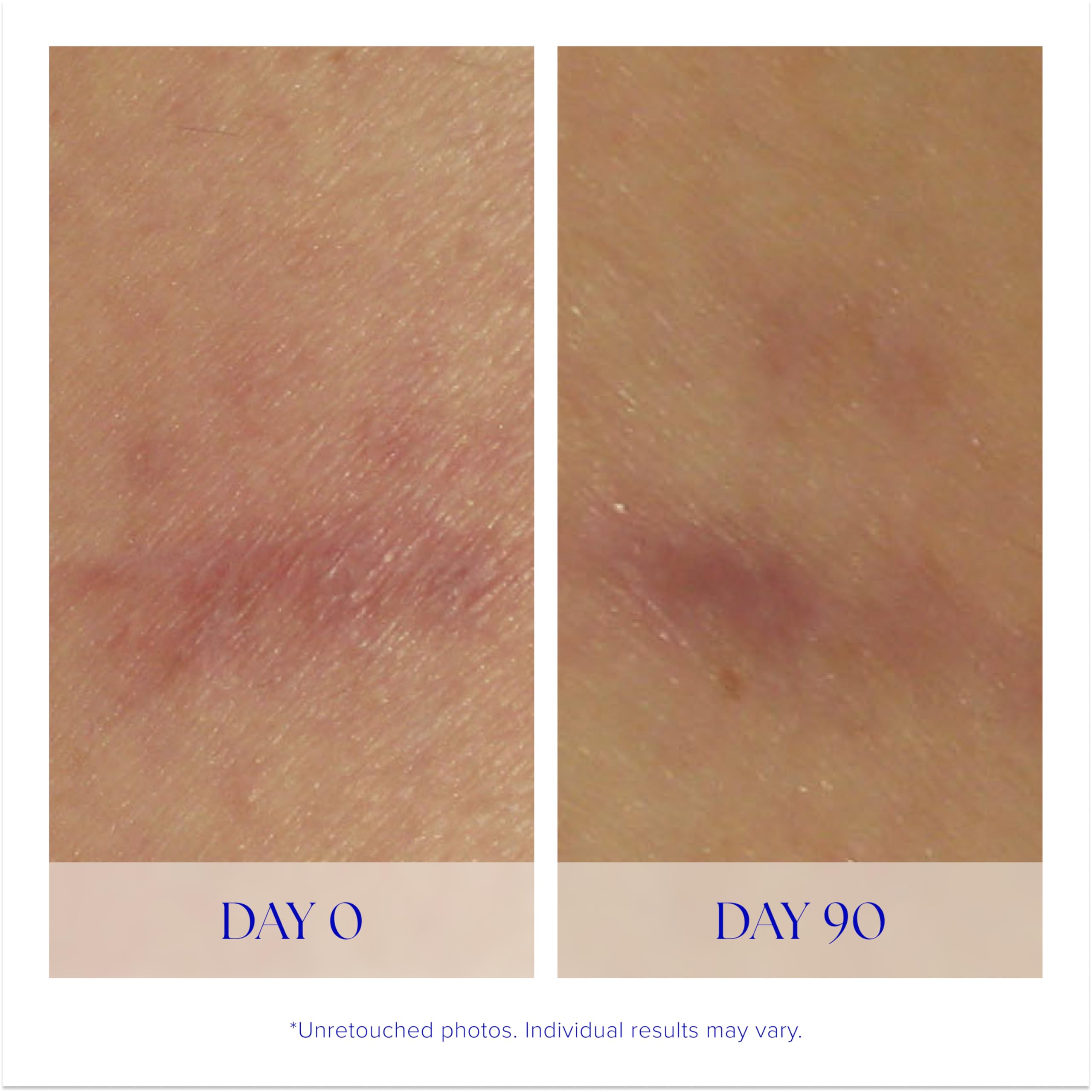 iS CLINICAL Super Serum Advance Anti Aging Vitamin C Face - Premium Selection Official Imagery - 5
