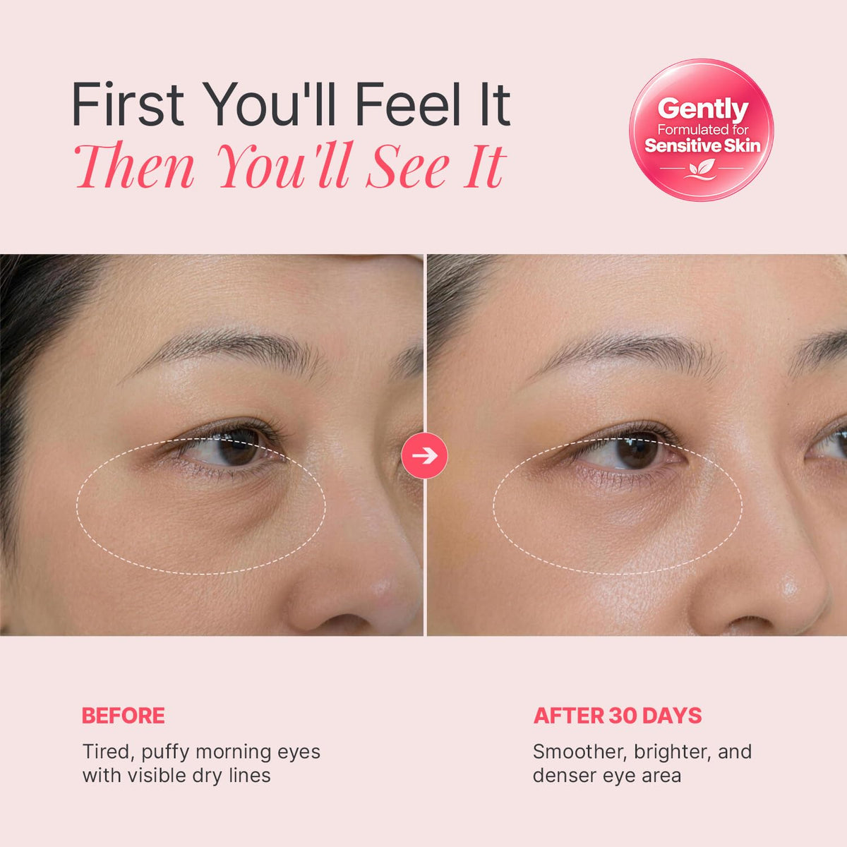 ENASKIN NATURALS PDRN NAD Anti Aging Eye Cream with Peptides - Enaskin Naturals Official Imagery - 5