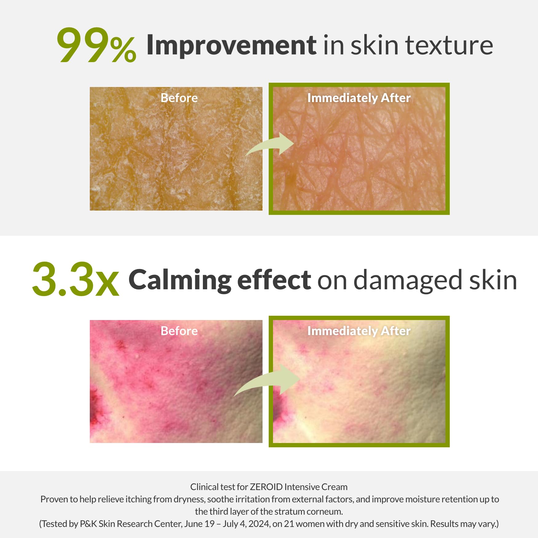 ZEROID Intensive Cream, 2.7 fl oz - ZEROID Official Product View 5