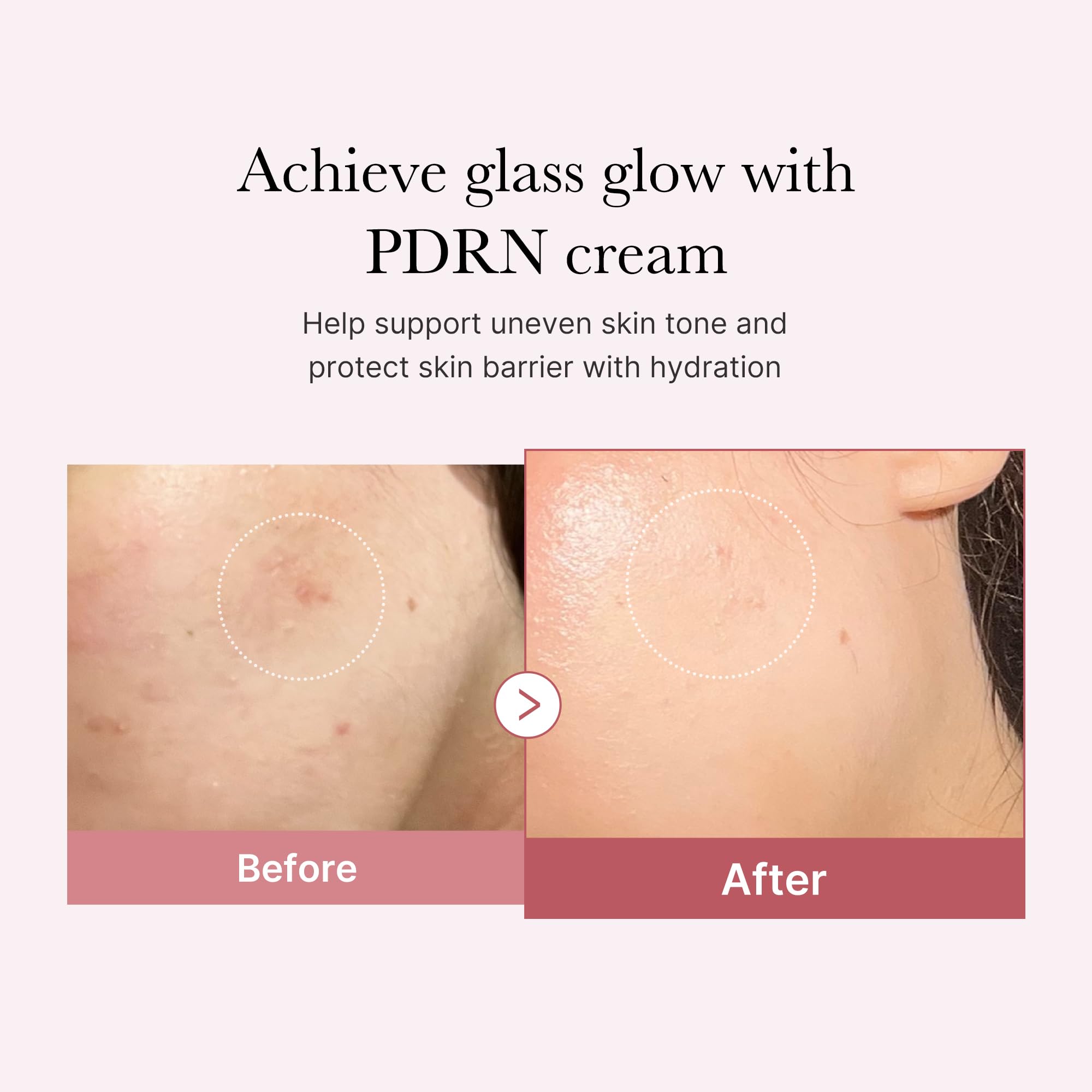medicube Rose PDRN Pink Hyaluronic Moisturizing Cream - medicube Official Product View 4