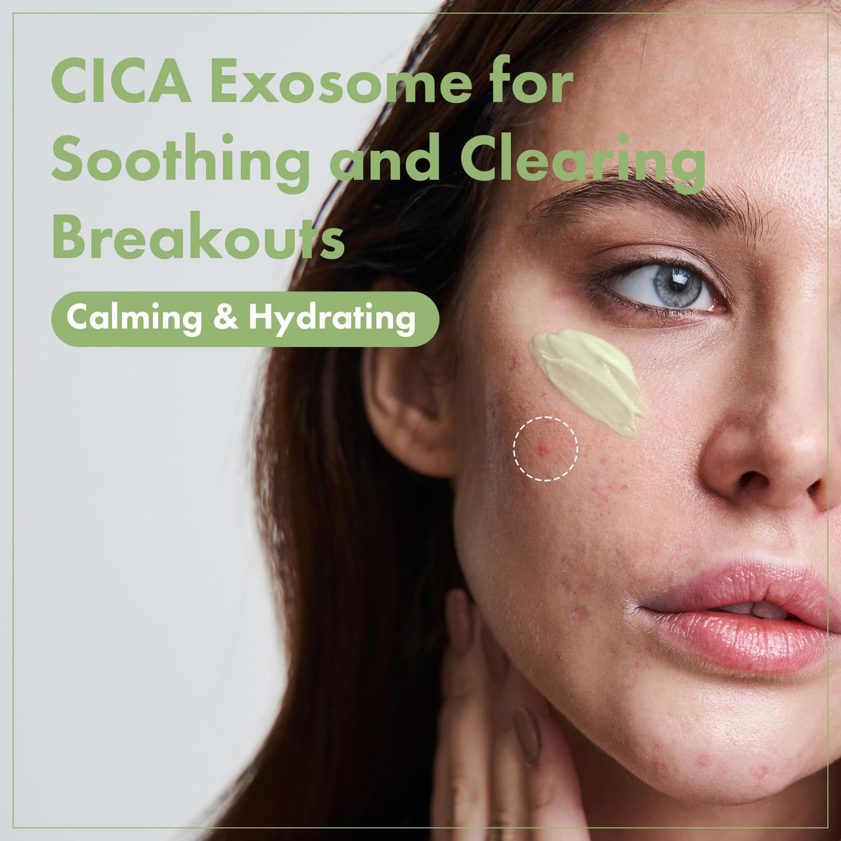TOSOWOONG Exosome CICA Face Cream for Redness Blemish Prone - TOSOWOONG Official Imagery - 3