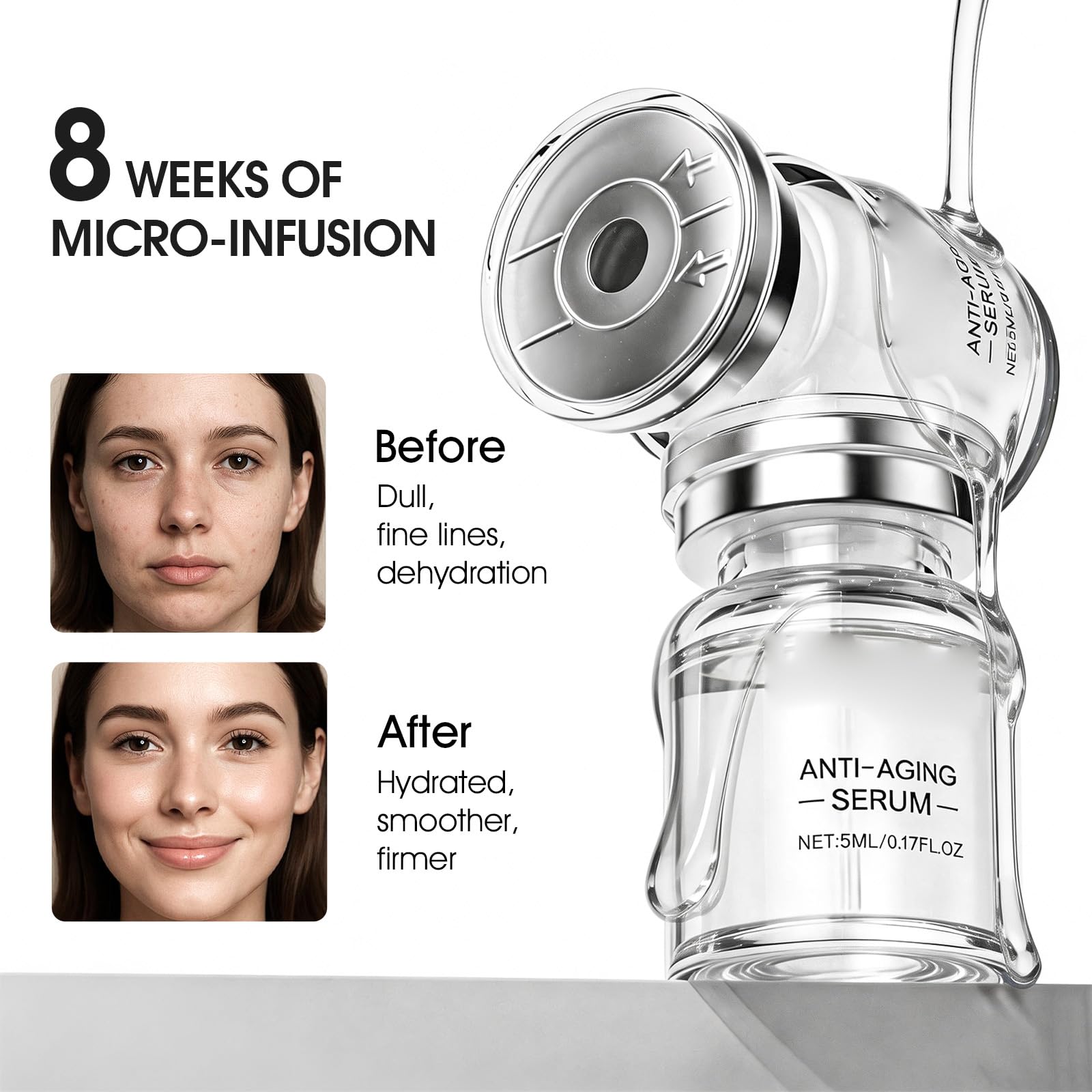 Manyi Micro Infusion System for Face Lips 0 25mm 24k Gold - Manyi Official Imagery - 6