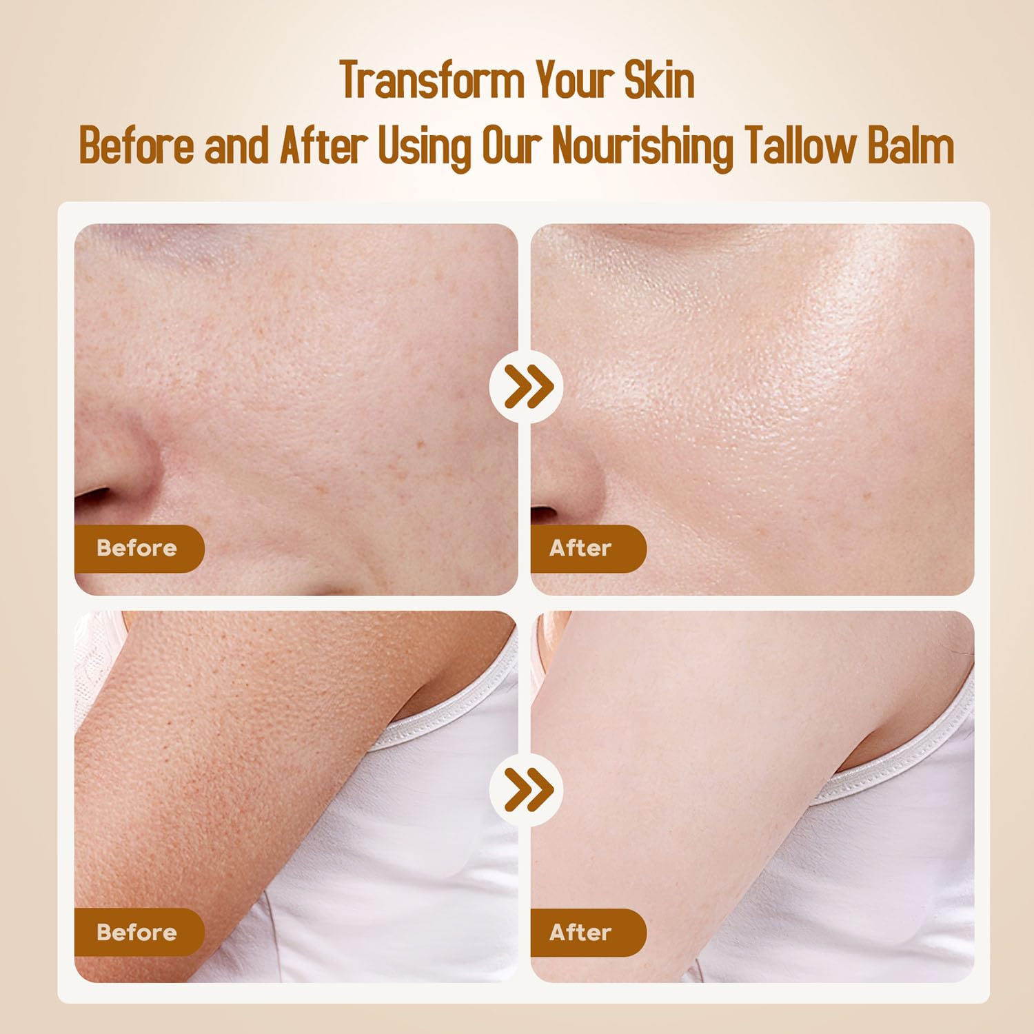Hicream Beef Tallow for Skin, Beef Tallow and Honey Balm, 100% Or - Hicream Official Product View 7