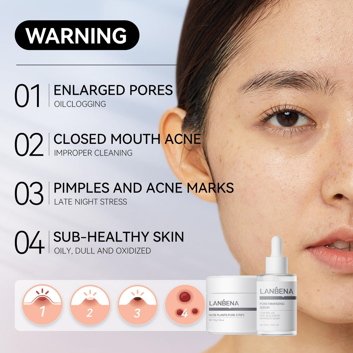 LANBENA 3 in 1 Blackhead Remover Set Pore Strips 30g Pore - LANBENA Official Imagery - 4