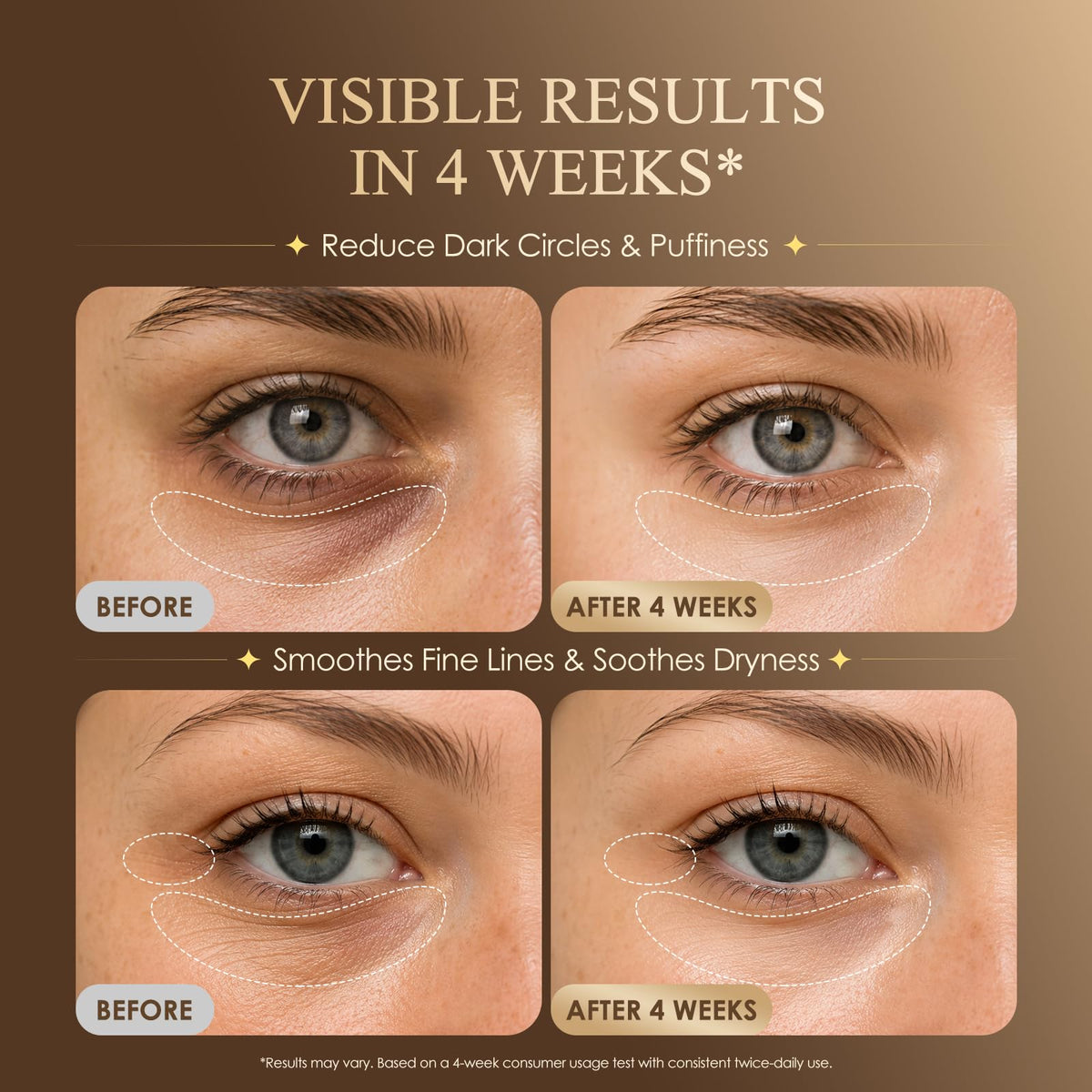 Under Eye Serum for Dark Circles Puffiness Caffeine Retinol - BIYSBER Official Imagery - 3