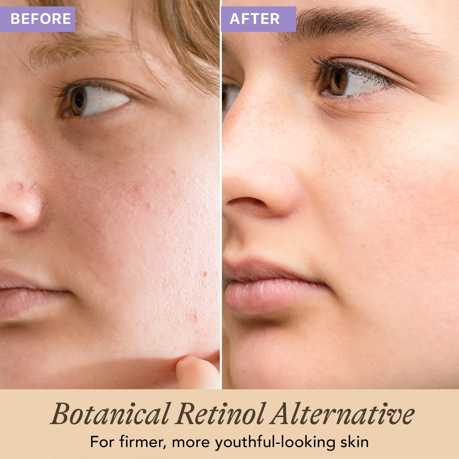 Beauty by Earth Bio Retinol Alternative Bakuchiol Serum - Smooths Fine Lines & - Beauty by Earth Official Product View 3