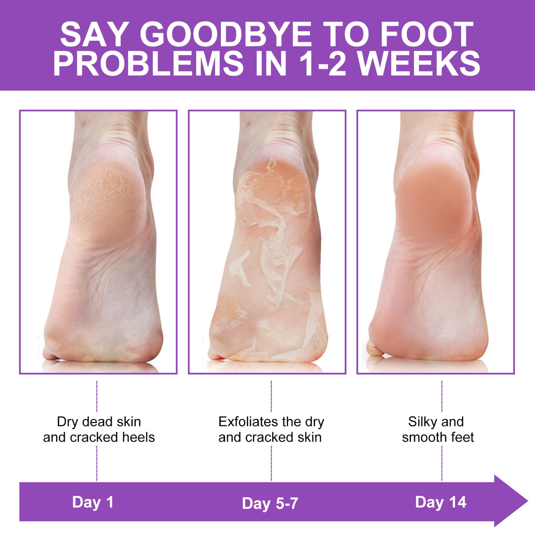 ALIVER Foot Peel Mask 3 Pack, Exfoliator Peel Off Calluses Dead Skin C - View 8