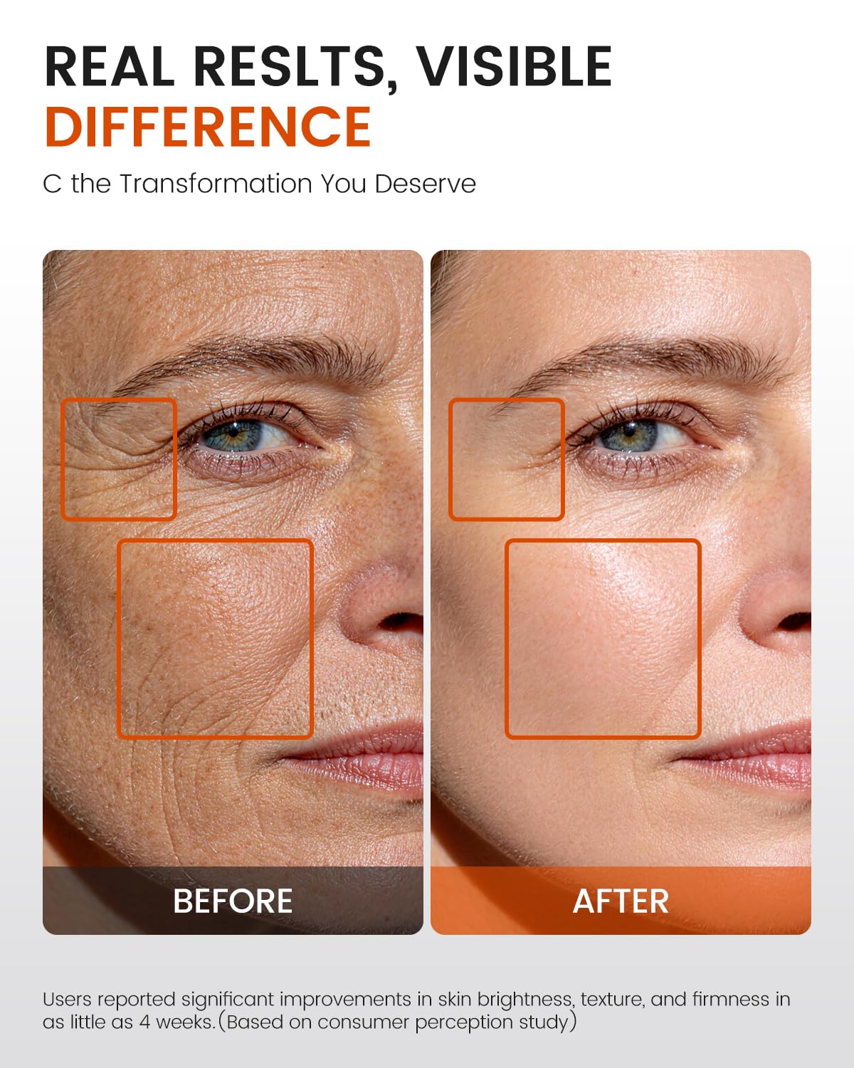 Super C Serum for Mature Skin All in One Vitamin C Serum for - Fioraen Official Imagery - 6