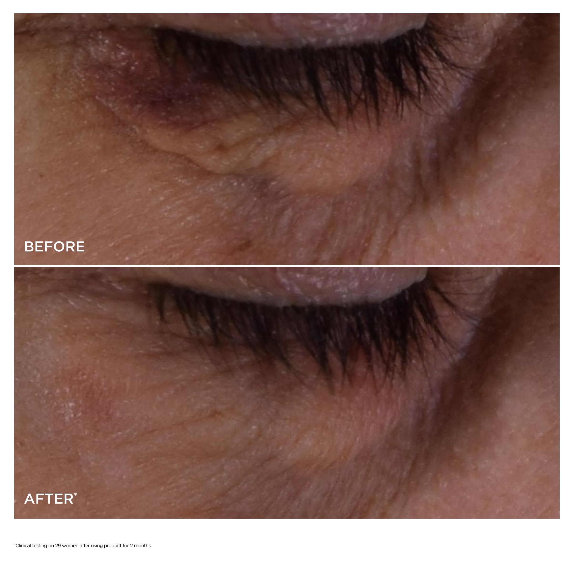 CLARINS NEW DOUBLE SERUM Eye Brightening Depuffing Anti - Premium Selection Official Imagery - 4