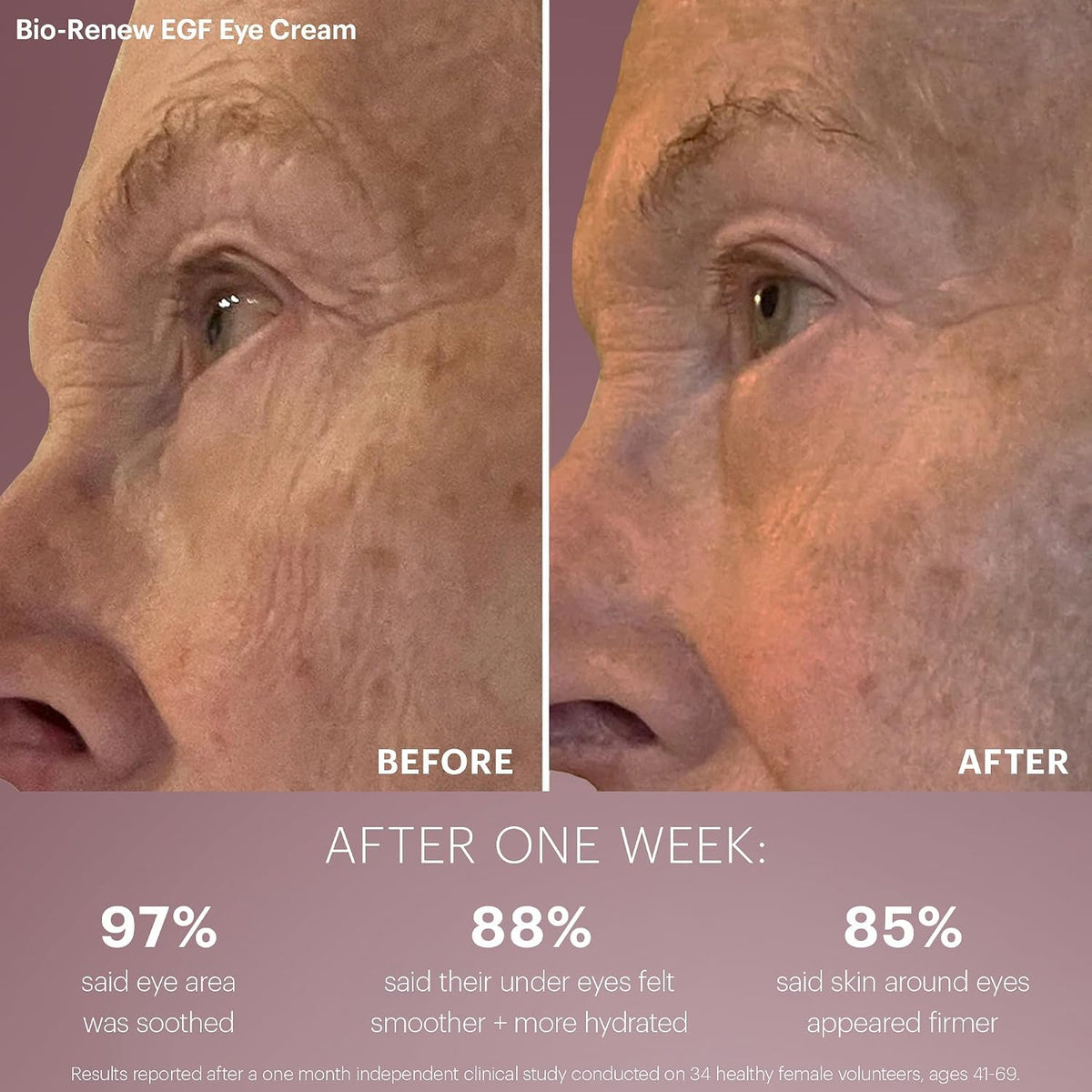 Glo Skin Beauty Bio Renew EGF Anti Aging Travel Discovery - Glo Skin Beauty Official Imagery - 7