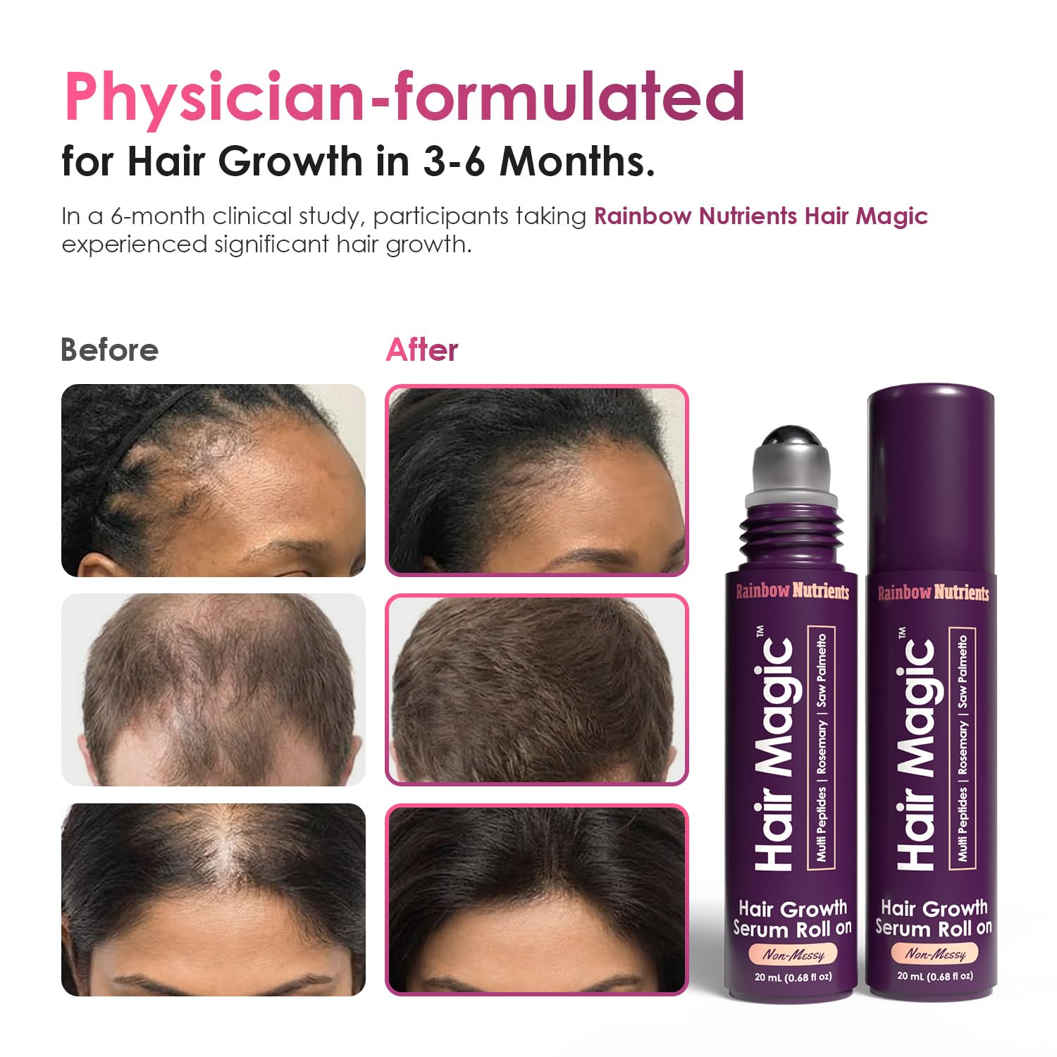 Rainbow Nutrients, LLC Hair Magic™ Hair Growth Serum Roll On - Multi Peptides + - Rainbow Nutrients, LLC Official Product View 4