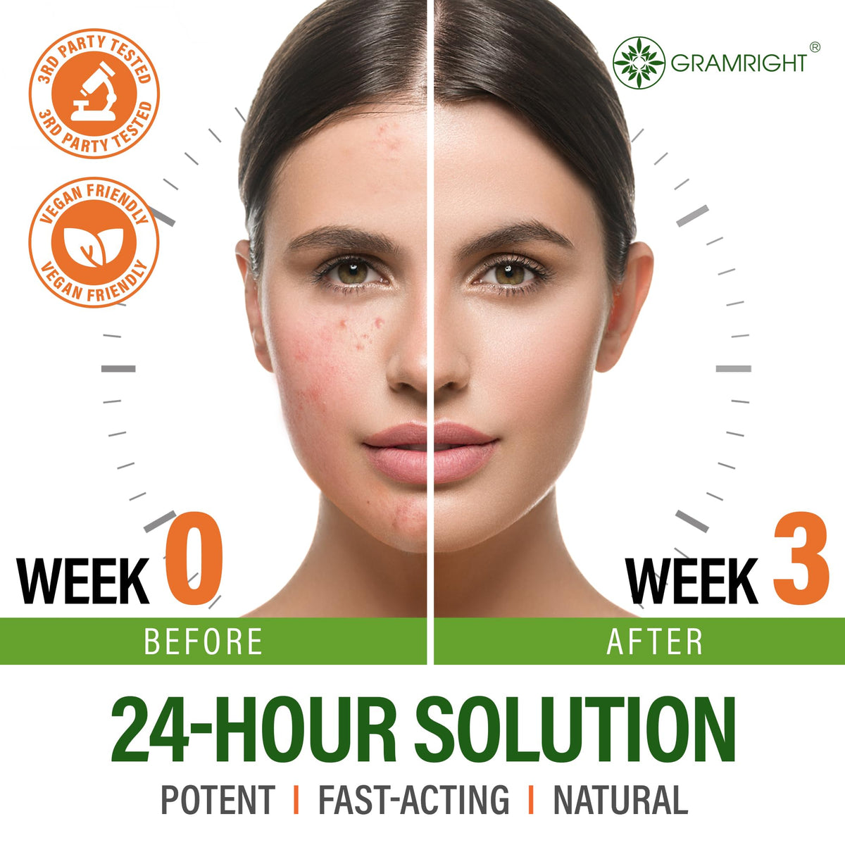 Salicylic Acid Face Cream - GRAMRIGHT Official Imagery - 4