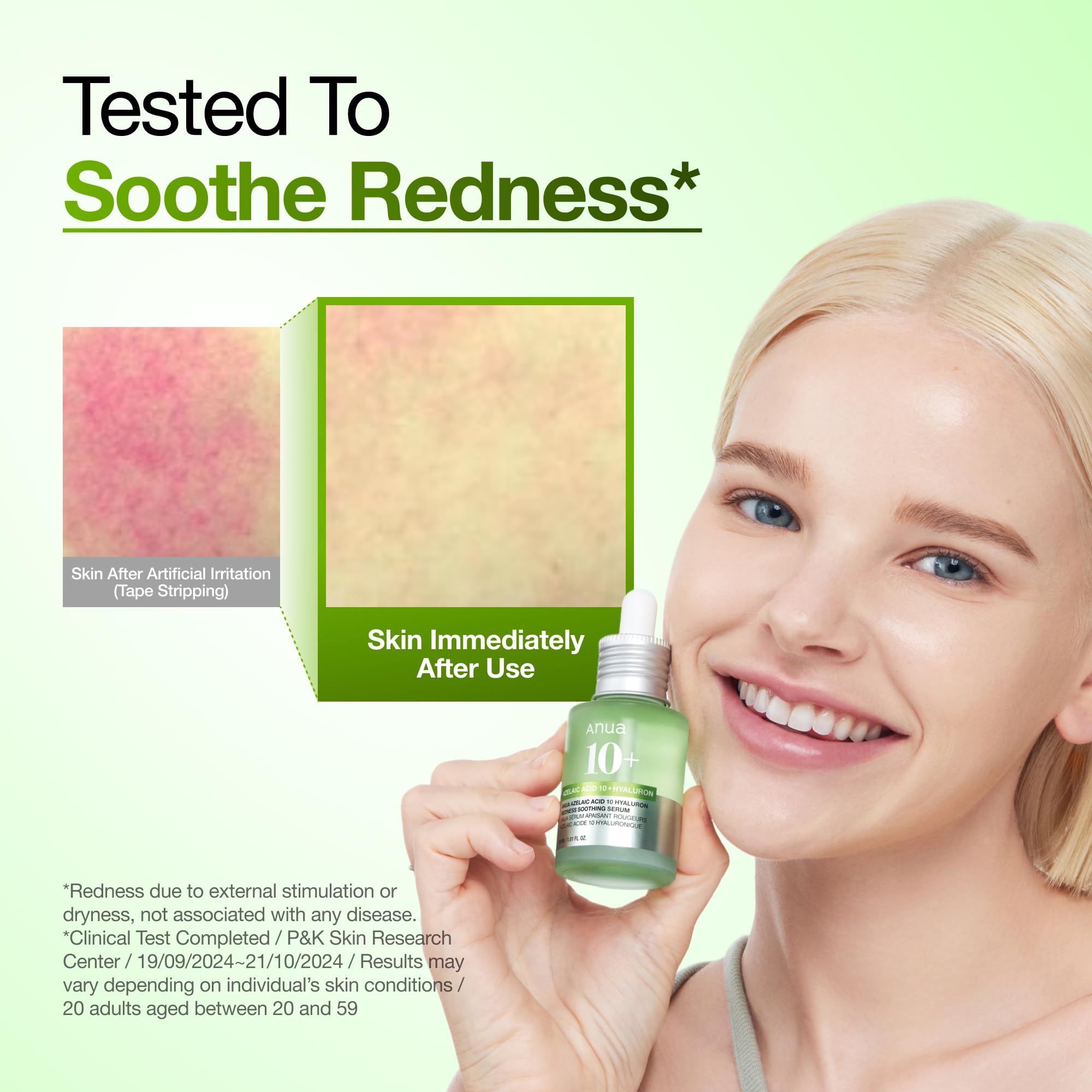 Anua Azelaic Acid 10 Hyaluron Redness Soothing Serum, 1.01 fl oz - ANUA