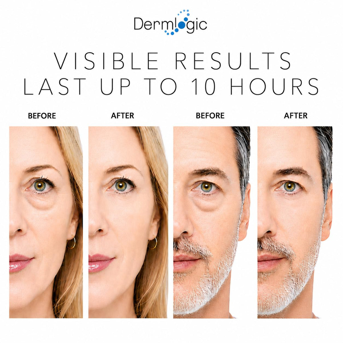 Under Eye Puffiness Dark Circles Rapid Treatment Instantly - Dermlogic Official Imagery - 5