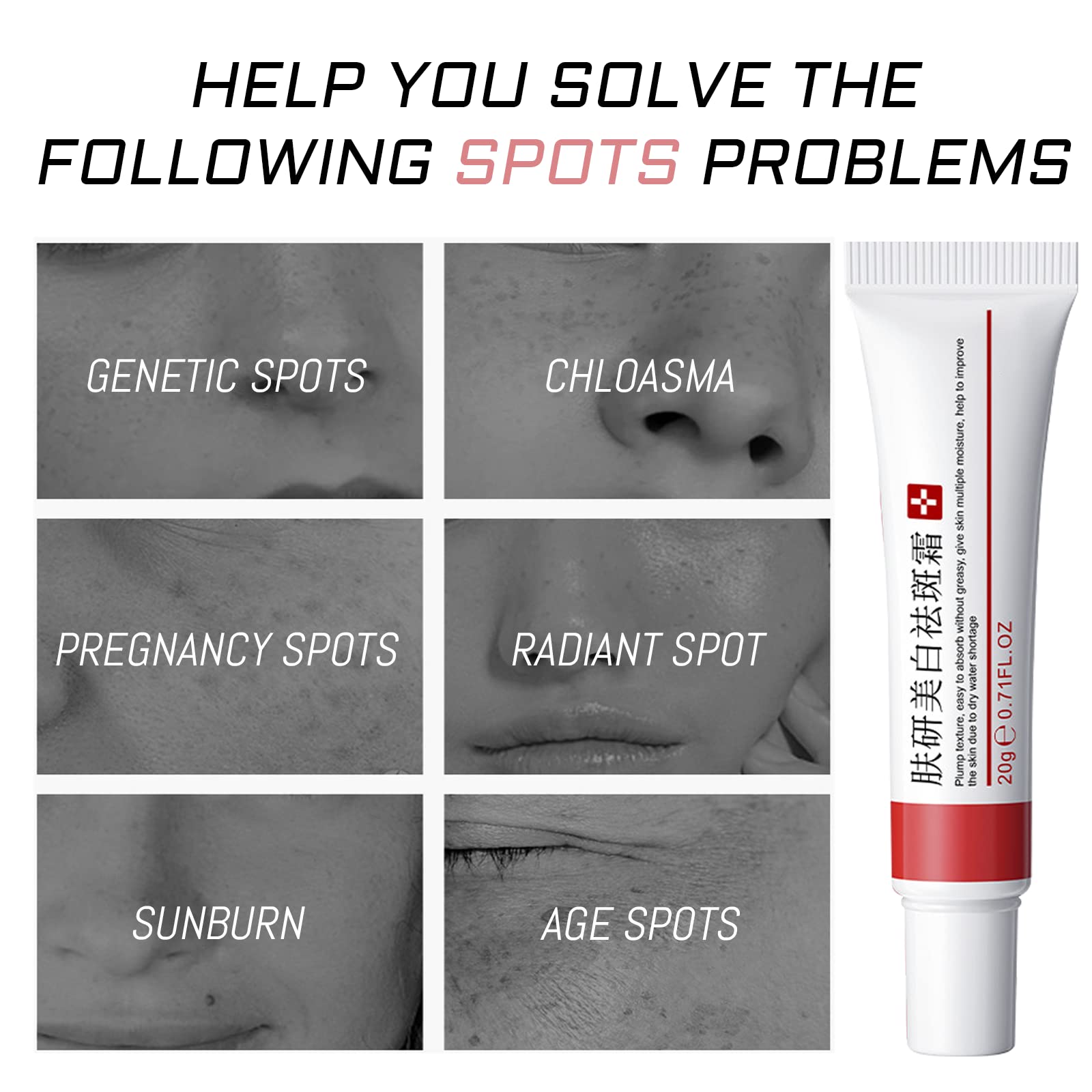 Fupah Whitening Freckle Cream 2-Pack – Dark Spot Remover