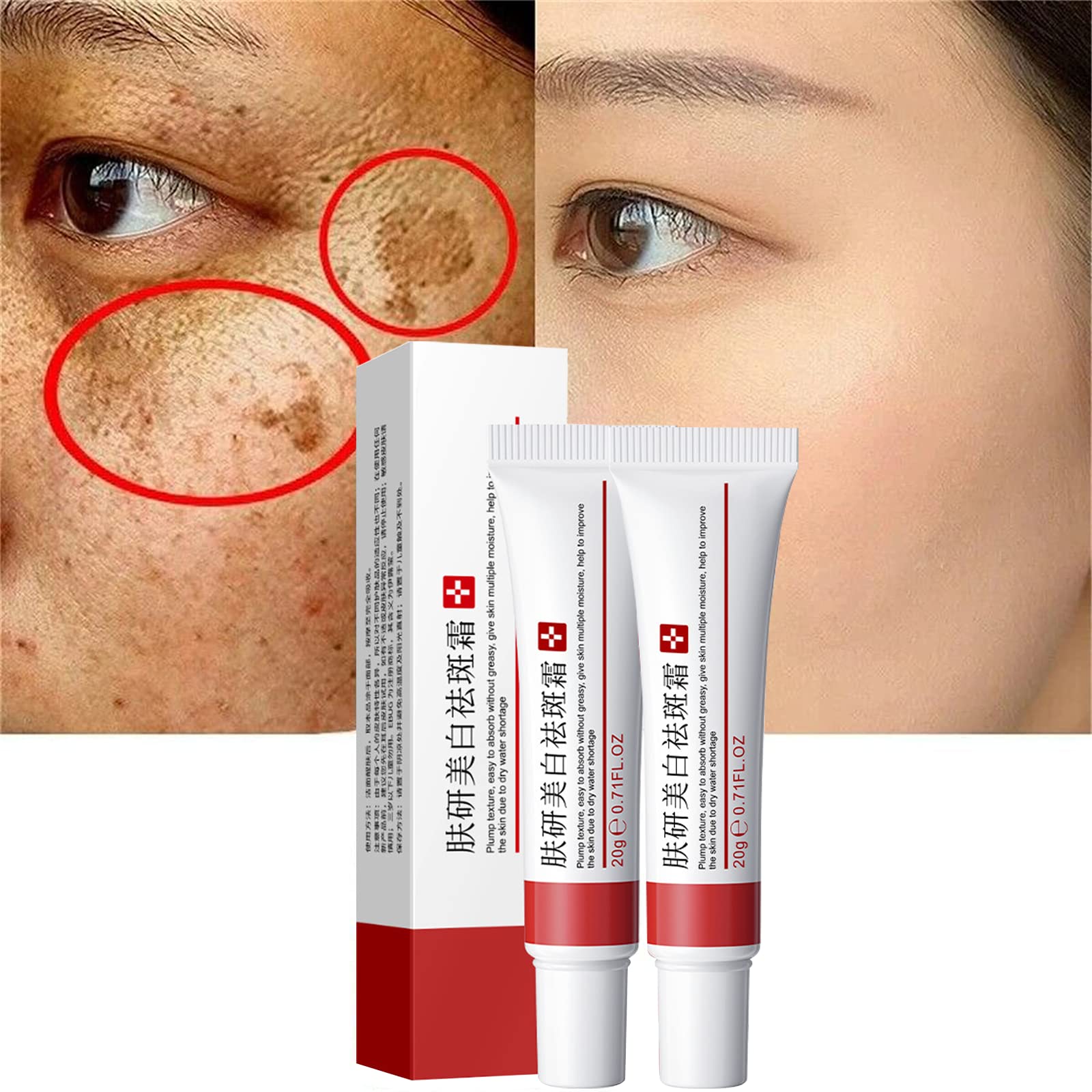 Fupah Whitening Freckle Cream 2-Pack – Dark Spot Remover