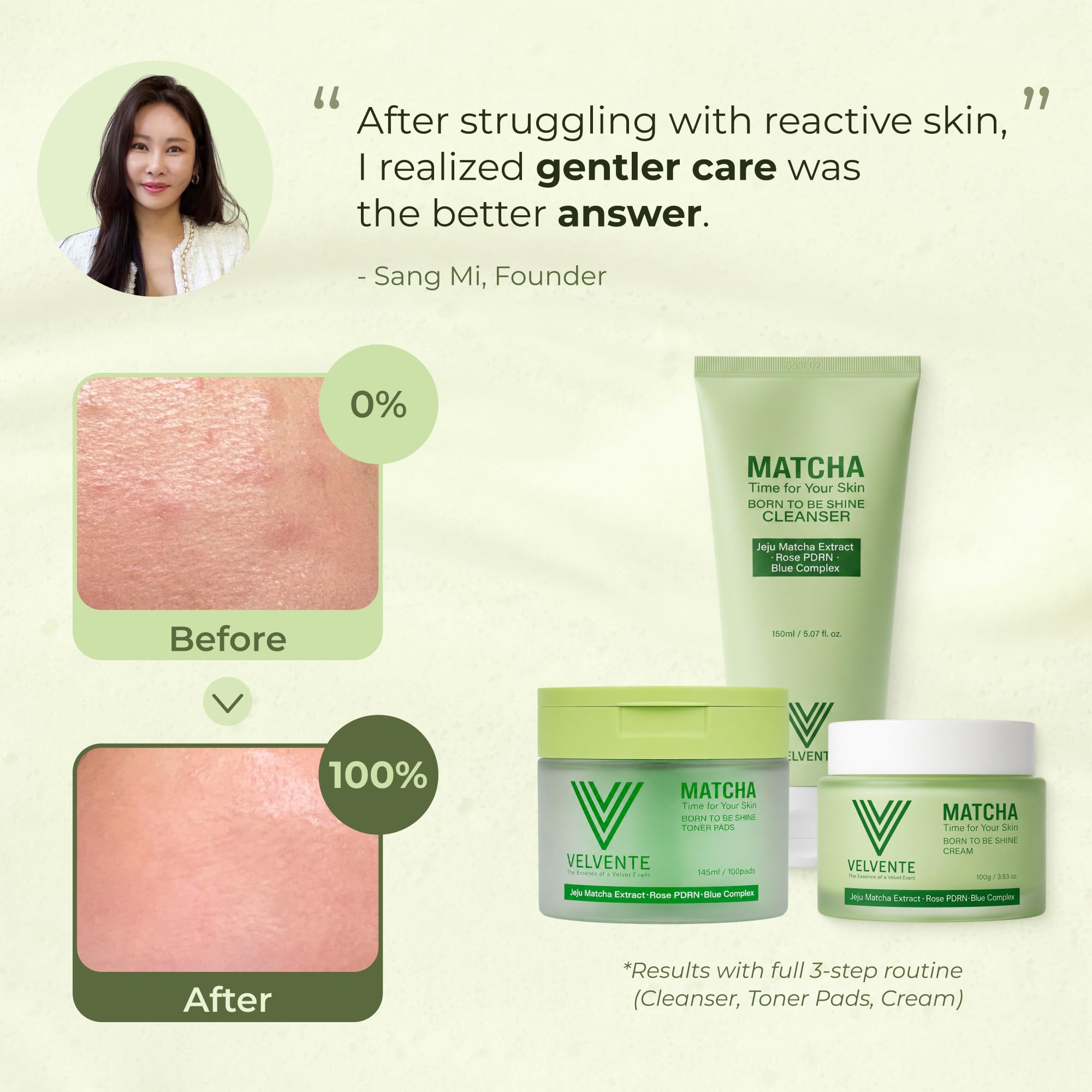 Matcha PDRN Korean Cleanser & Face Wash, Acne-Prone Sensitive... - VELVENTE Official Product View 10