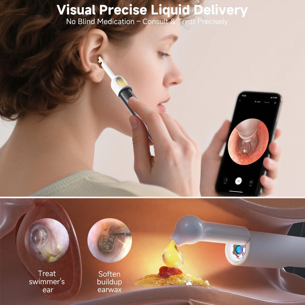 BEBIRD R1 Ultra Ear Wax Removal Tweezers 1296P HD Ear Camera - BEBIRD Official Imagery - 7