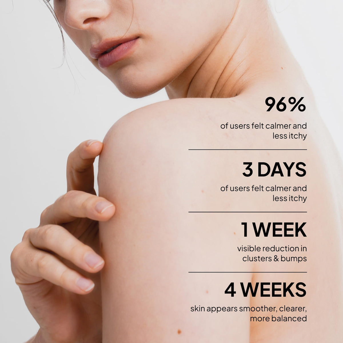 BellamiLuxx Fungal Acne Treatment Lotion Effective Face Body - BellamiLuxx Official Imagery - 4