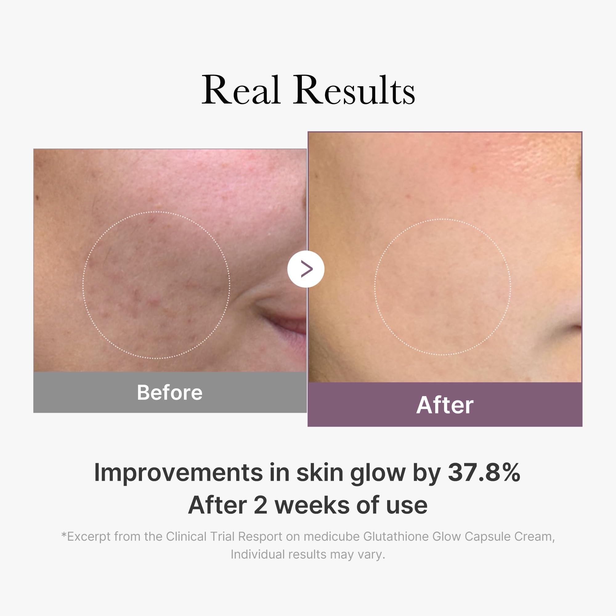 medicube AGE - R Glutathione Glow Capsule Facial Cream - medicube Official Product View 6