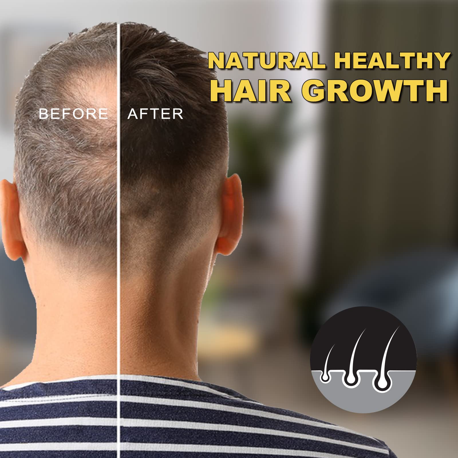 SOLEMEONY 5% Minoxidil Hair Growth Serum - for Stronger Thicker Longer & Hair Reg - SOLEMEONY Official Product View 6