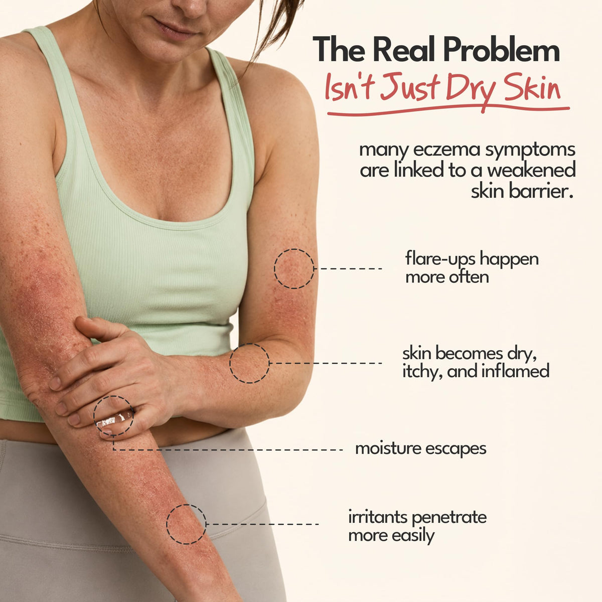 STRAWBERRY Barrier Repair Eczema Relief Cream Colloidal - STRAWBERRY Official Imagery - 4