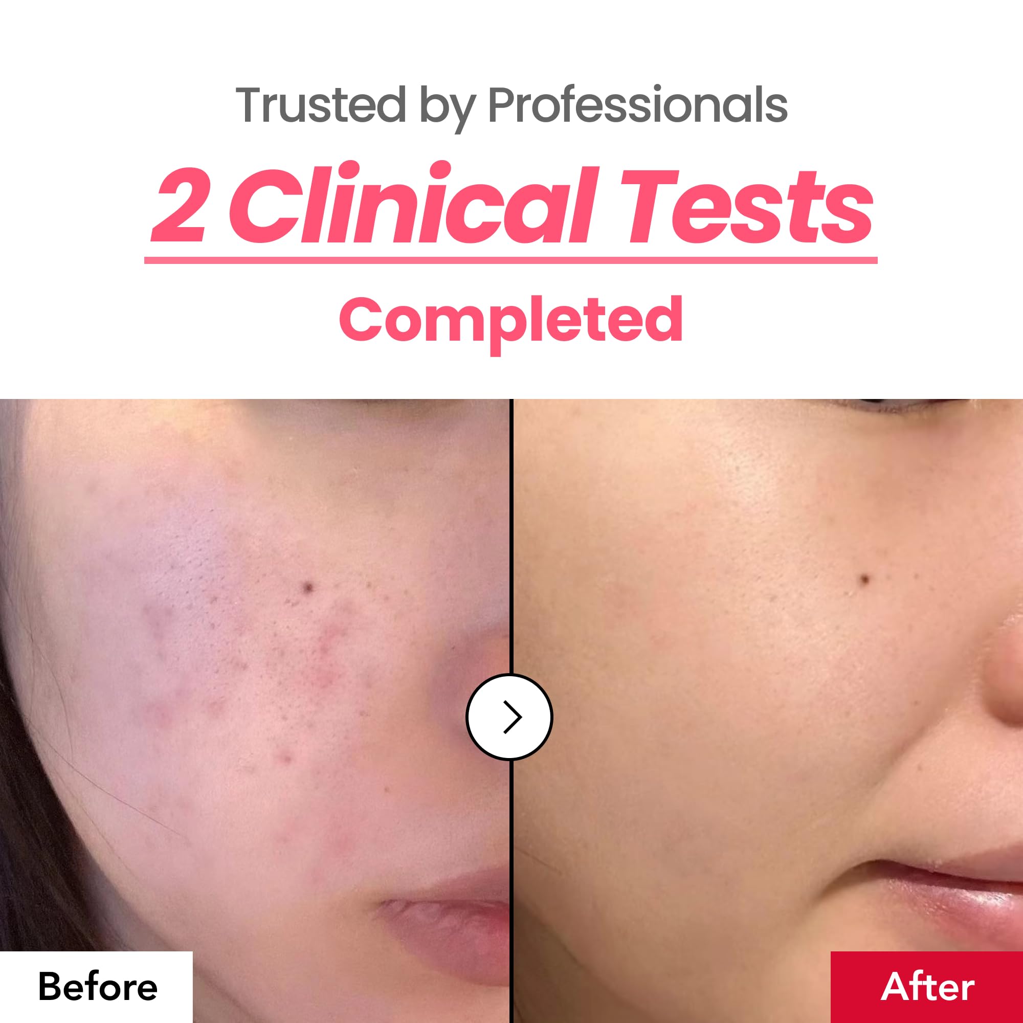 dr.percent Dark Spot 24% Correcting Pink Glow Cream - Tranexamic Acid 6% & - dr.percent Official Product View 6